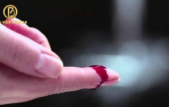 Trong tháng 7 âm lịch bị đứt tay thì nên xử lý như thế nào?